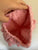 Handmade pink bobble beanie hat Sz 3-6 approx, as new